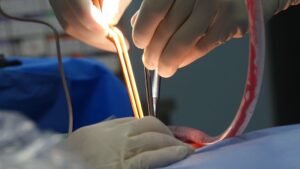 frequent routine complications described
